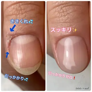 ネイル テテト *ネイルのネイルデザイン
