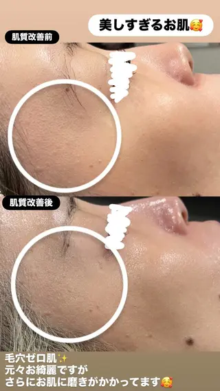 LiZA エステティックサロンのエステ・リラクイメージ