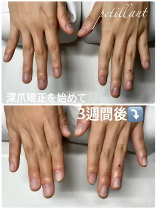 ネイル nail salon petillantのネイルデザイン