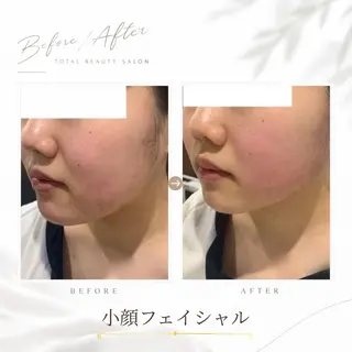 《 肌質×美肌 》 addissimoのエステ・リラクイメージ