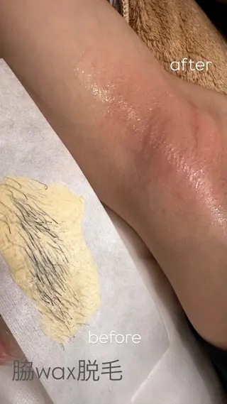 なみ|WAX脱毛専門 店|さいたま市のエステ・リラクイメージ