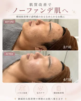 韓国肌管理専門店 eimy🌿minaのエステ・リラクイメージ