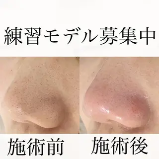 nuit ニュイのエステ・リラクイメージ