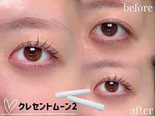 マツエク・マツパ 似合わせデザイン💎 Jolie ryoのマツエク・マツパデザイン