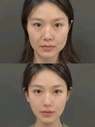 アイブロウ 愛維美水光専門店 川崎彩鳳のエステ・リラクイメージ