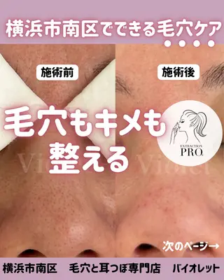毛穴と耳つぼ専門店 バイオレット　りののその他イメージ