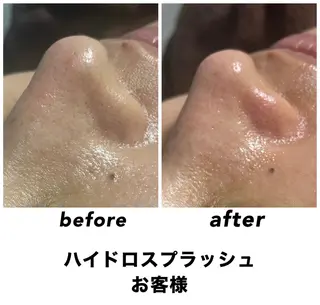 ネイル・エステサロン UILANIのエステ・リラクイメージ