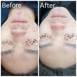 肌質改善Beauty salon Renのエステ・リラクイメージ