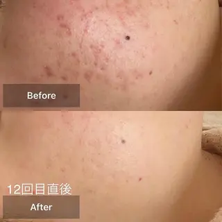 メンズ キッズ 美肌と癒しのサロン Lu,Mieのエステ・リラクイメージ