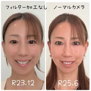 小顔と ヘッドスパのお店のエステ・リラクイメージ