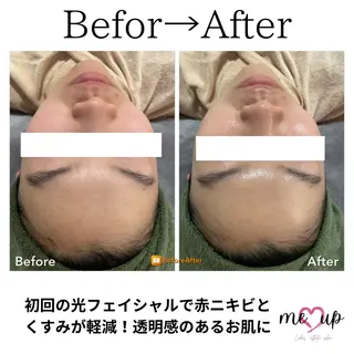 Meupニキビ専門店 背中/ハーブ/肌管理のその他イメージ