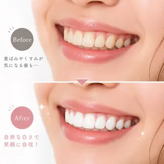 モナネイル ＡＩのネイルデザイン