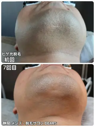 メンズ 山村幸久 メンズ脱毛 ディアーズのエステ・リラクイメージ