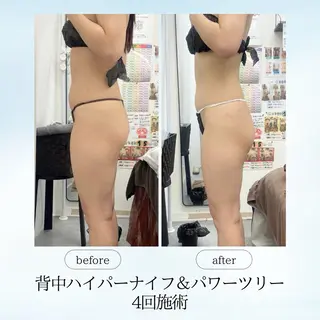 《痩身、小顔専門店》 エスプレッソのエステ・リラクイメージ