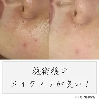 ニキビ経験者が施術 する専門サロン🌻のエステ・リラクイメージ