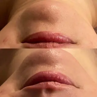 毛穴から始める肌メン テマンダリンオレンジのエステ・リラクイメージ