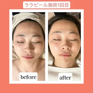 💜Karen PrivateSpaのエステ・リラクイメージ
