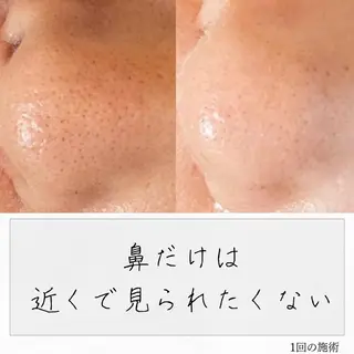 ニキビ経験者が施術 する専門サロン🌻のエステ・リラクイメージ