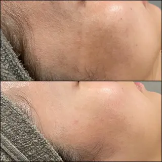 LiZA エステティックサロンのエステ・リラクイメージ