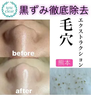 BeautyNail eyelashのネイルデザイン