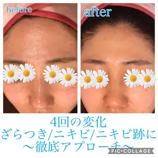ロング カラー パーマ ヘアアレンジ キッズ ネイル マツエク・マツパ EnsorClair 代表 野口真央のエステ・リラクイメージ
