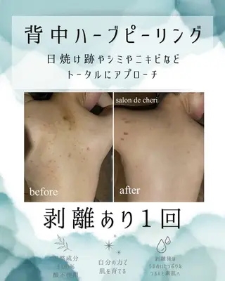 医療提携 肌管理痩身エステ池袋のエステ・リラクイメージ