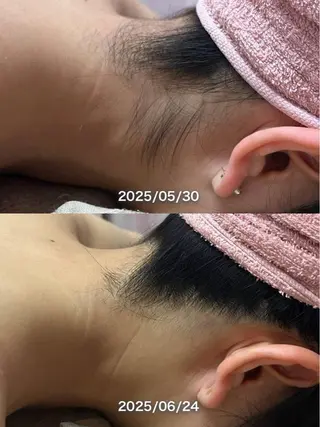 【都度払い可】 脱毛 サロンドジェシカのエステ・リラクイメージ