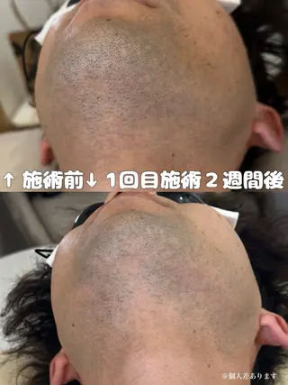 メンズ muumo まりののエステ・リラクイメージ
