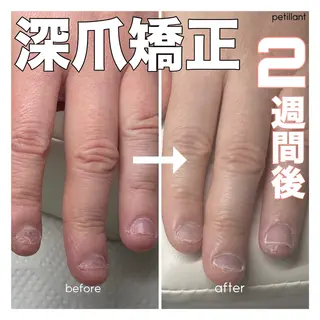 ネイル nail salon petillantのネイルデザイン