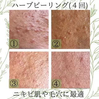 韮沢 いづみのエステ・リラクイメージ