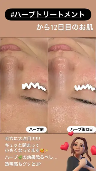LiZA エステティックサロンのエステ・リラクイメージ