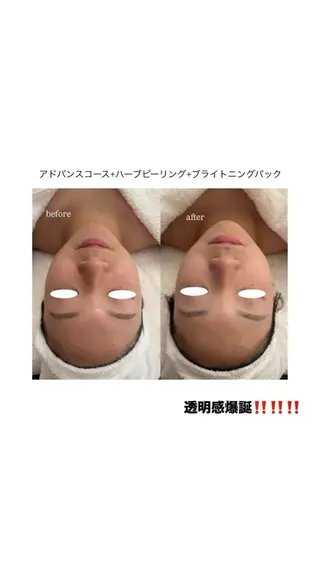 フェイシャルエステ 🎀　naoのエステ・リラクイメージ