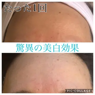 ミディアム カラー パーマ ヘアアレンジ キッズ ネイル マツエク・マツパ EnsorClair 代表 野口真央のエステ・リラクイメージ