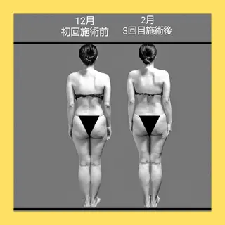 Ichi Fluo rite Bodyのエステ・リラクイメージ