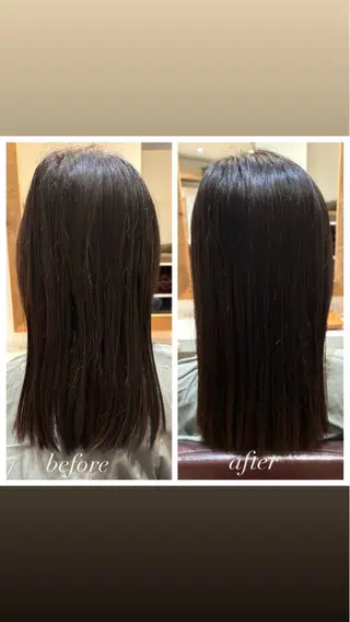 セミロング 痛くないシミ取り 【荻窪】石橋のエステ・リラクイメージ
