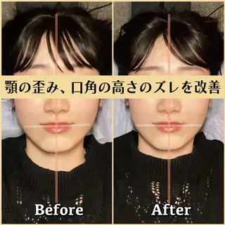 歪み専門💫筋膜整体 はたやまきんま君💪のエステ・リラクイメージ