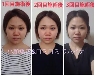 小顔矯正 ラハイナのエステ・リラクイメージ