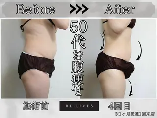 痩身&小顔矯正専門店 Re:Livesのその他イメージ