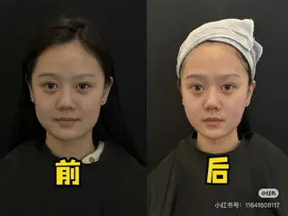 ネイル 愛維美水光専門店 川崎彩鳳のエステ・リラクイメージ