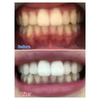 M渋谷 セルフホワイトニングのエステ・リラクイメージ