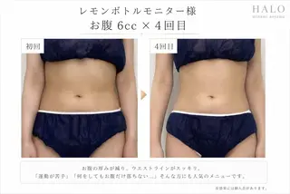 小顔痩身HALO 二宮早織のエステ・リラクイメージ
