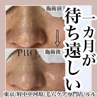LULU ルルのエステ・リラクイメージ