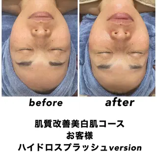ネイル・エステサロン UILANIのエステ・リラクイメージ