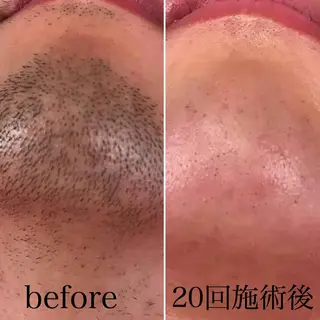 men's calonのエステ・リラクイメージ