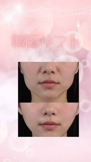 マツエク・マツパ 愛維美水光専門店 川崎彩鳳のエステ・リラクイメージ