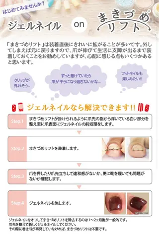 ネイル ♢ME2ROOM♢ #巻き爪#リラクのネイルデザイン