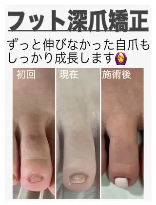 ネイル nail salon petillantのネイルデザイン