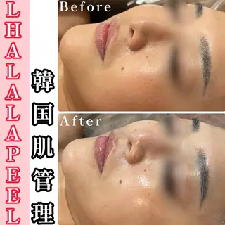 韓国肌管理🫧艶肌 ニキビケア🩵本町店のエステ・リラクイメージ