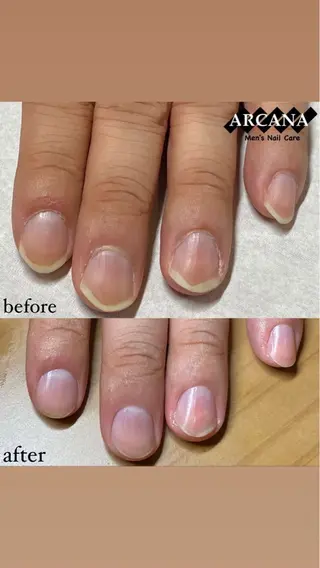 メンズ ネイル 山﨑 可穏のネイルデザイン