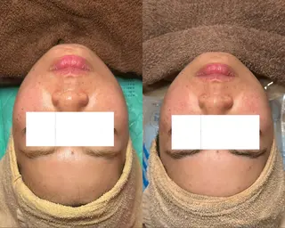 a room salonのエステ・リラクイメージ